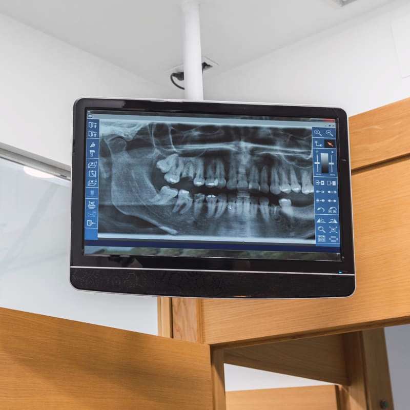 Dental Technology, Antigonish Dentist